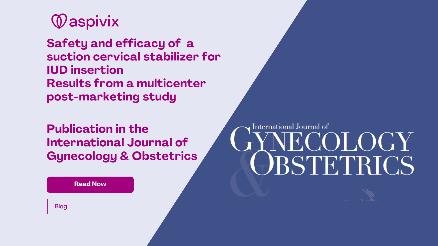 Aspivix and carevix featured in the International Journal of Gynecology & Obstetrics