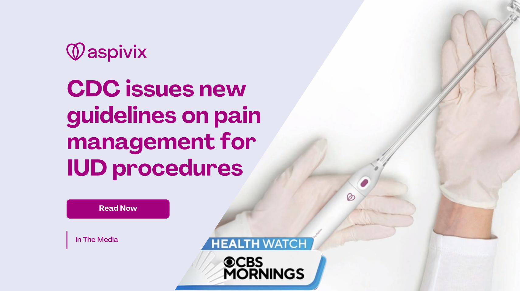 CDC Issues new Guidelines on pain management for IUD procedures