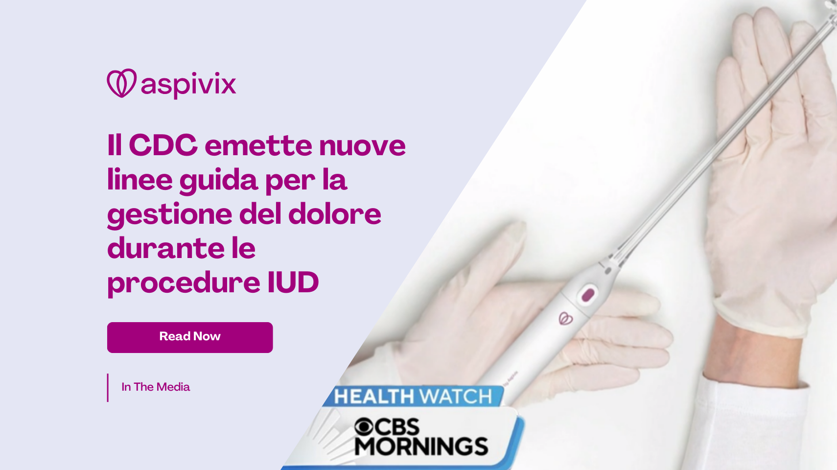 CDC issues new guidelines on pain management for IUD procedures