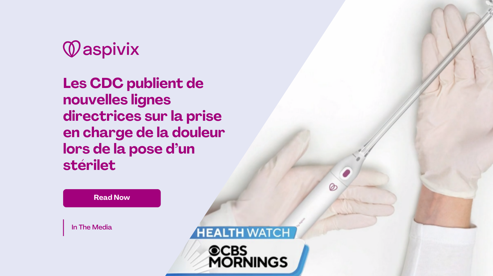 CDC issues new guidelines on pain management for IUD procedures
