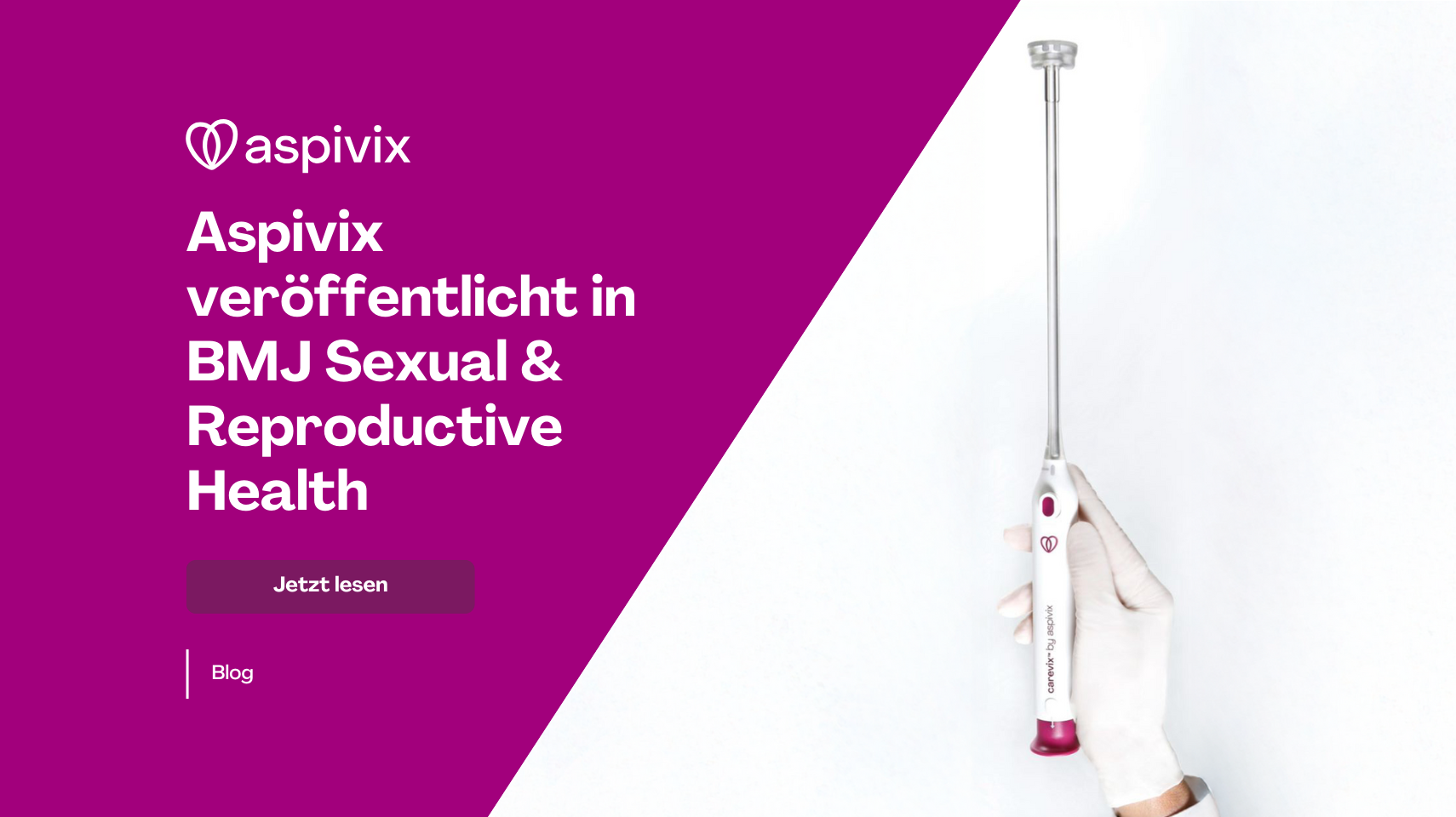 DEUTSCH Aspivix published in BMJ Sexual & Reproductive Health