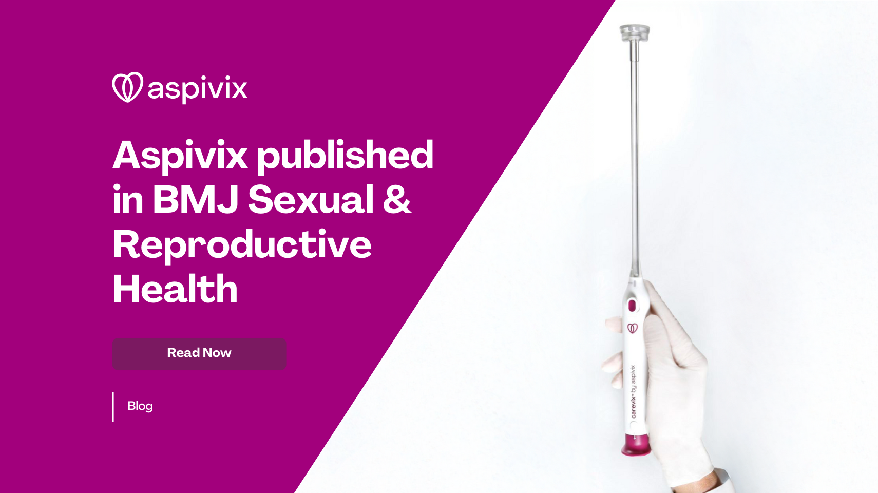 ENGLISH Aspivix published in BMJ Sexual & Reproductive Health