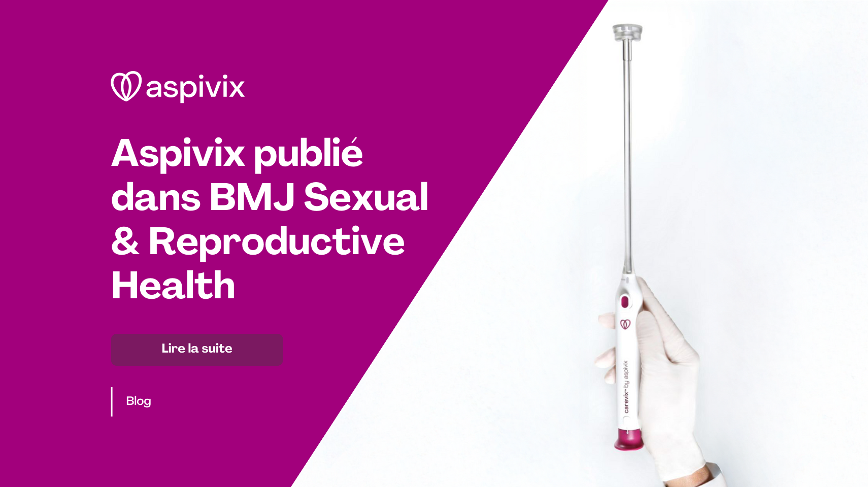 FRENCH Aspivix published in BMJ Sexual & Reproductive Health