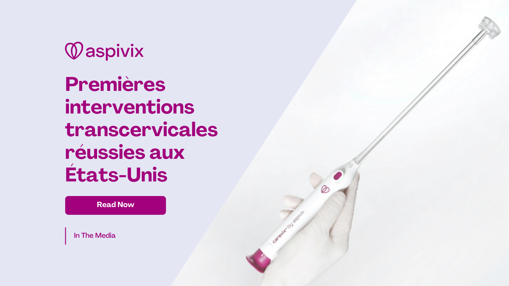 First Successful Transcervical Procedures in the US