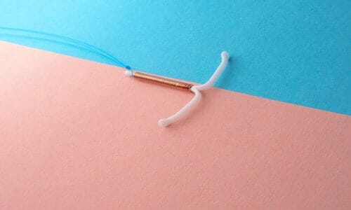 IUD (1)