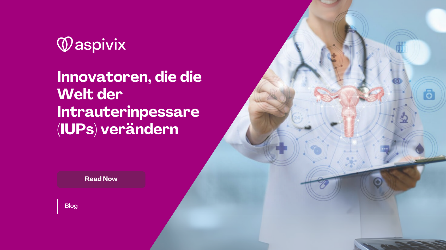 Innovators Transforming the World of Intrauterine Devices (IUDs) Innovators Transforming the World of Intrauterine Devices (IUDs)