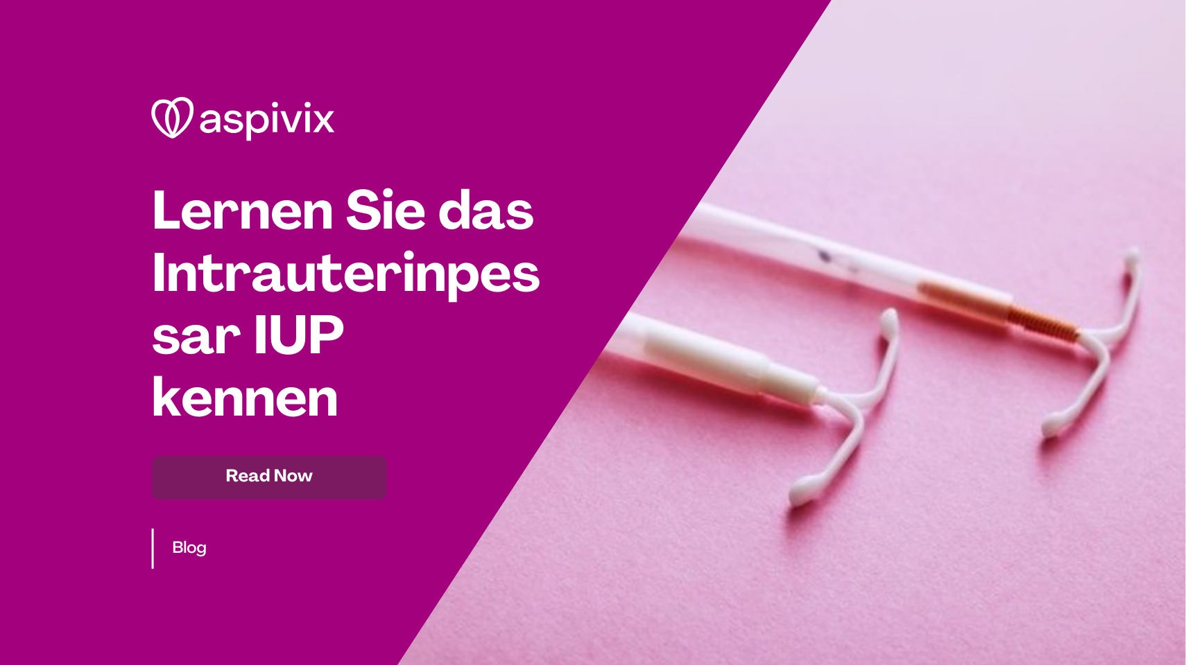 Meet the Intrauterine Device IUD Meet the Intrauterine Device IUD