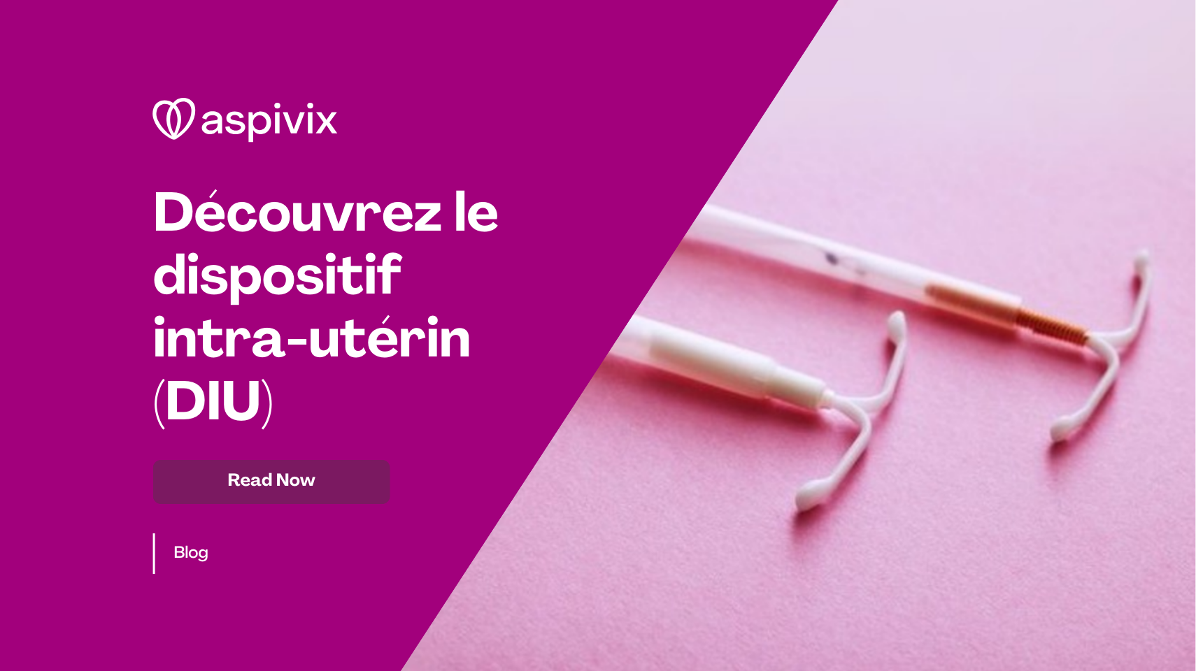 Meet the Intrauterine Device IUD