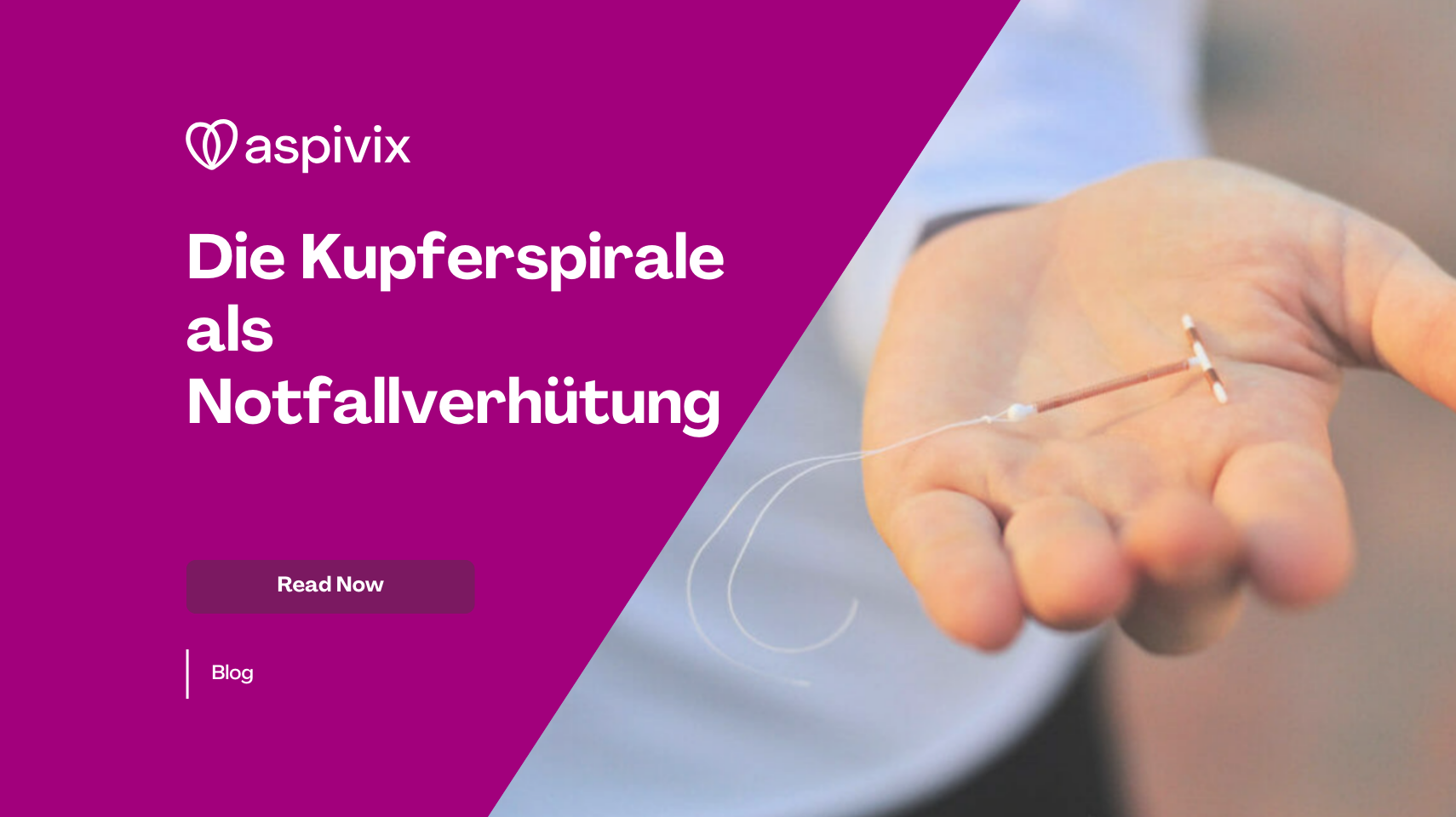 The Copper IUD as Emergency Contraception