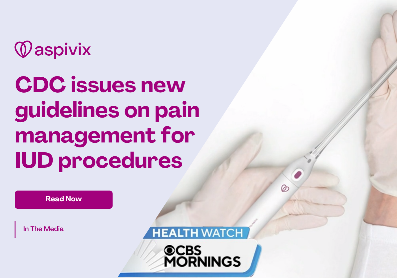 CDC Issues new Guidelines on pain management for IUD procedures